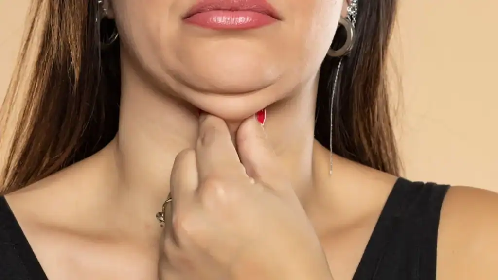 An image of a woman with double chin, sad, worried : Non Surgical Double Chin Removal Treatment in Cannock, UK
