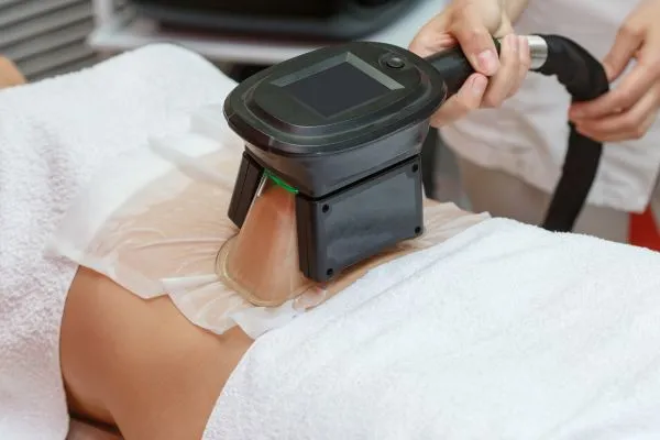 Image of person having fat freezing treatment to help weight gain Cannock