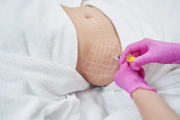image of fat dissolving injections on love handles to help combat weight gain Cannock