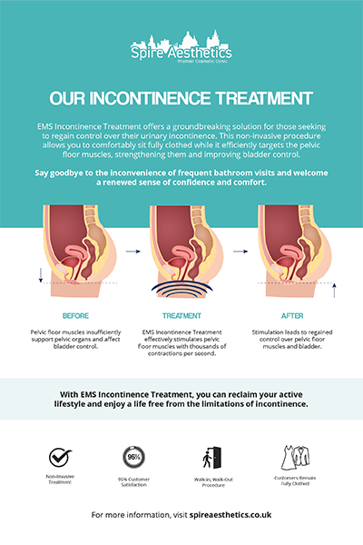image to show how EMS treatment works for female urinary incontinence Cannock