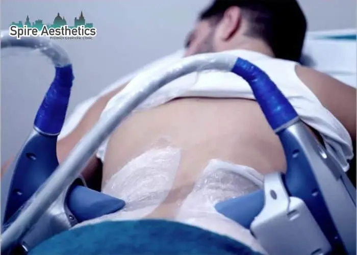 Man having fat freezing treatment done on love handles before a competitions Cannock to create a sculpted look.