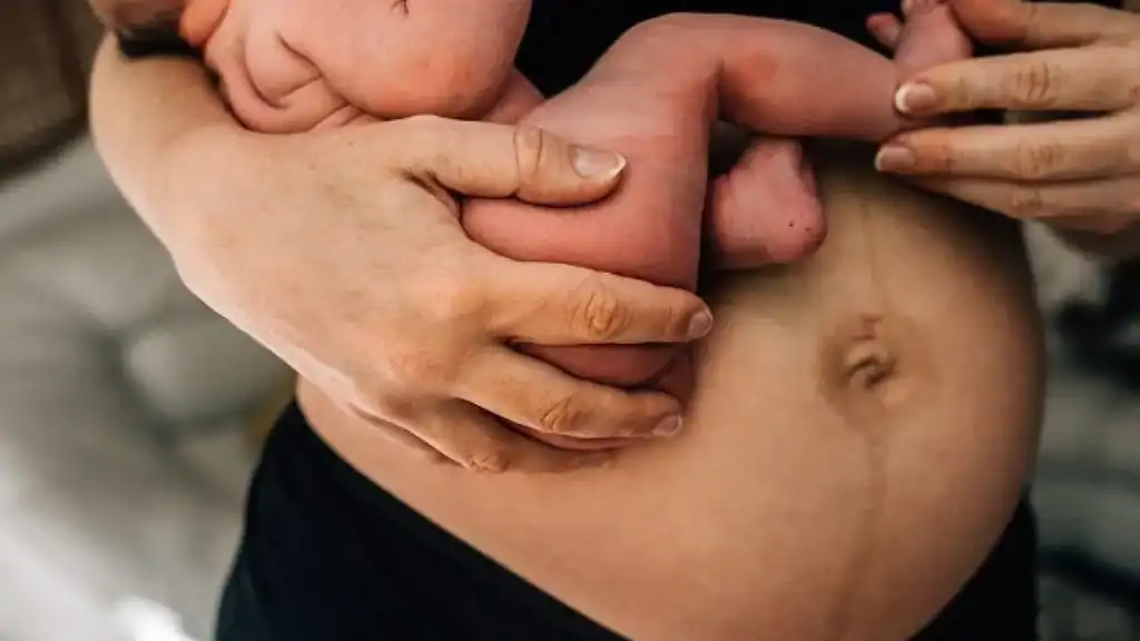 Why Is My Stomach Still Big After Pregnancy Cannock?